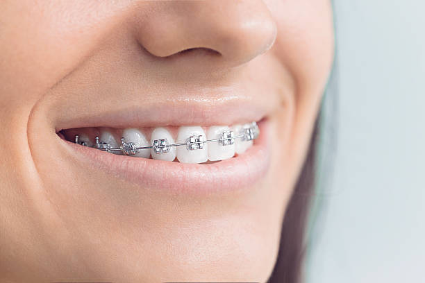 Best Dental Bonding  in Florence, TX